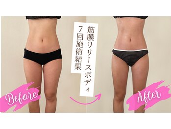 ルー(Lu)/施術結果写真