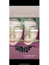 マリー(Mary.)/サーマルフラクショナル