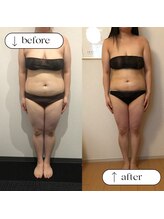 トータルビューティーサロンリア(Li'a)/ビフォー＆アフター