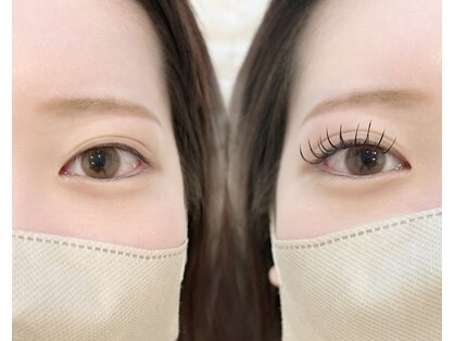 ミリ(.mm)の写真