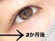 ジラッシュ(G/ash)/【まつげパーマ】2か月後