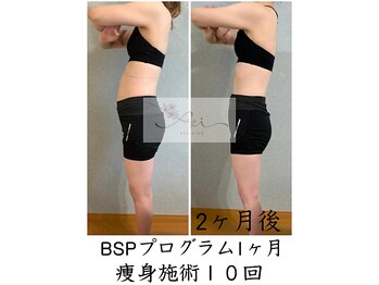 アイ エステサロン(Ai)/【30代】落ちなかった体重が…