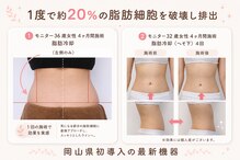 シュシュ(chouchou)