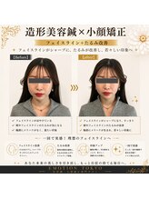 エモシオン トウキョウ(EMOTION TOKYO)/造形美容鍼×小顔矯正