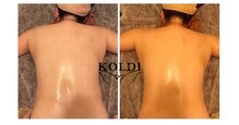 コルディ(KOLDI)