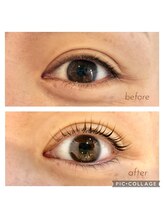 シェリーガーデン/育毛を促すアディクトカール