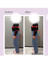 ルナ(Runa)/美容整体◆1回の効果