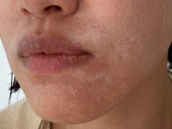 ディアナ 代々木上原(_Diana)/グリーンピール/Diana代々木上原