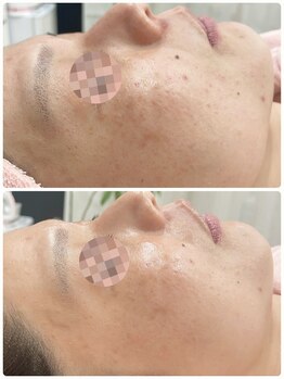 プチ プロムナード(Petit Promenade)/美肌フェイシャルワックス