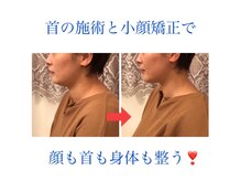 カオリン(顔凛)