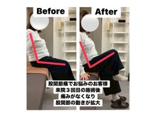 アンティオール 札幌店/50代女性　股関節まわりの痛み