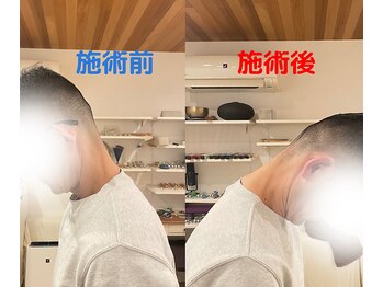 さくらの整体院/50代男性、慢性的な首肩のこり