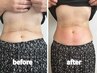 【美くびれ集中】ぽっこりお腹/下腹部スッキリ★　　9,500円→4,900円