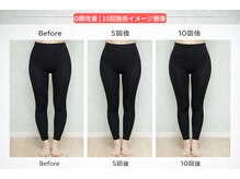 整音(totonone)の雰囲気(結果重視の短期集中プラン)