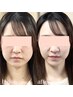 《結果続々》極み手技の小顔矯正　体験60分¥2,980
