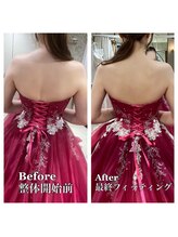 ライズ/背中のビフォーアフター