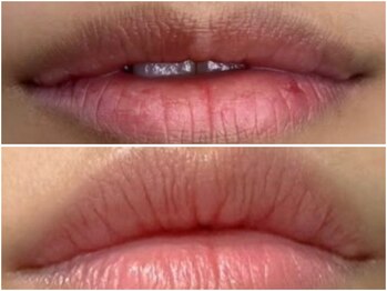 ピンクアンドプラウドサロン 横浜(Pink& Proud Salon)/ローマピンク【唇】