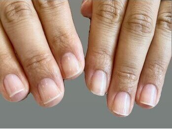 デアフローラ(deaflora)の写真/≪皮膚科医監修特許ケア製品使用≫県内希少なハンドケアの専門技術◎日々忙しく,ついつい荒れがちな指先に