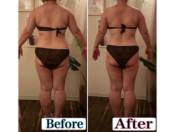 トータルビューティーサロン 凛/痩せたね!と褒められる自分