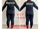 ヨサパーク エテノア(YOSAPARK etenoa)の写真/頑固なセルライトやむくみにも効果的！痩せにくい太ももの悩みがあるかたも一度お試しください！