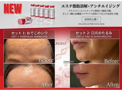 美ネージュの写真