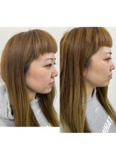 ナノハナ/鹿沼市の全身脱毛美容室ナノハナ