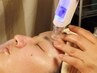 【ニキビ予防やニキビケアに】刺さない美容鍼の肌質改善アンコールクーポン♪