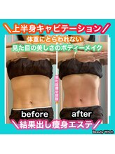 ビューティ ウィッチ(Beauty Witch)/