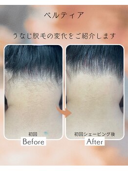 ビューティサロン ベルティア(Beltia)/#脱毛#ダイエット#ブライダル