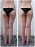 たるみ足、たるみ足、ぶよぶよ脂肪足　老化予防エイジング美脚90分コース