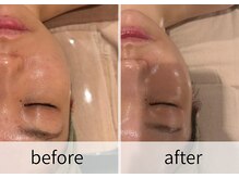 スパジュエル(SPA JEWEL)/