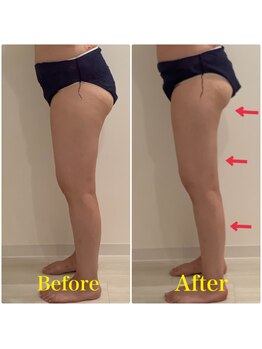 スペチアーレ 夙川/浮腫みをとってスッキリ美ボディ