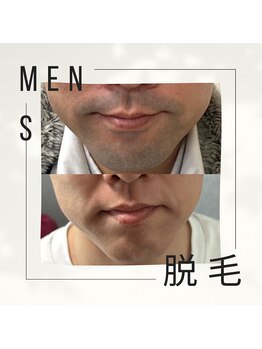 アンベリール(Embellir)/頑固なお髭もツルすべ肌に♪