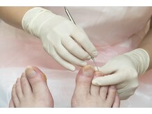 アヴィ CoCoLo新潟店(A'VI)/巻き爪などのお悩みにも対応