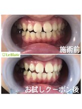 ルブラン 奈良店(Le Blanc)/初回限定格安クーポン！