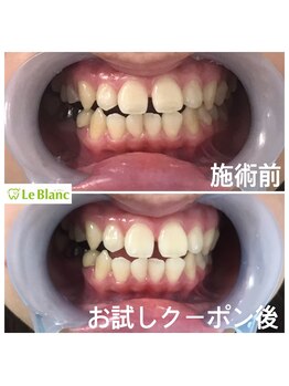 ルブラン 奈良店(Le Blanc)/初回限定格安クーポン！