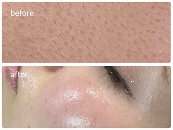 リジョーナ 一宮店(Lijona)/人から褒められるほどの肌へ。