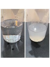 トータルビューティ リライフ(Total beauty Relife)/毛穴洗浄マシン