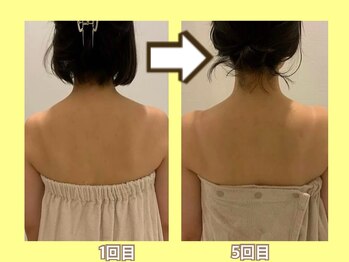 ビオール 池袋店(beall)/大人気!オーダーメイド痩身90分