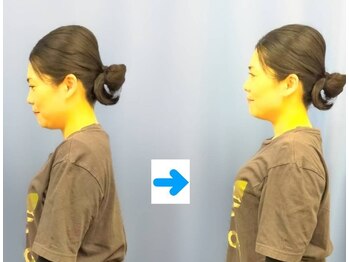 いのくち接骨院/姿勢改善の症例