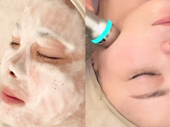 アトリエリュバン 梅田店(atelier Ruban)の写真/歴20年×施術3万件の医療機関と提携サロン【美肌の土台を育む】ダウンタイムなしの水玉リフトで水光肌♪