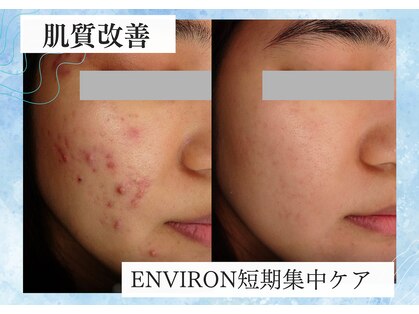 アンジェラックス スキンケアセンター心斎橋の写真