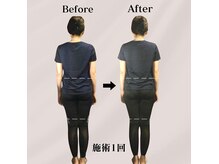 デアルーチェ(DEA LUCE)の雰囲気（美骨矯正/骨盤矯正/肩こり解消/小顔矯正/猫背巻き肩改善/美脚）