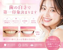 エクシアホワイトニング 調布店