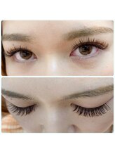 モッズ(M.O.D)/バインドロック