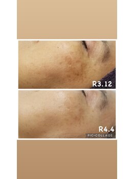 ビラ ベルダ(Bira Beldad)/