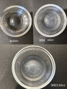 アール アンド ビューティーサロン(Ｒ＆ BeautySalon)/毛穴洗浄で汚れゴッソリ！