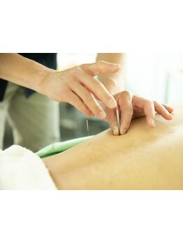 鍼灸施術を受けたい