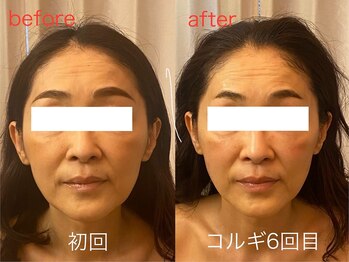 ビーキュート 神戸元町店(BE-CUTE)/コルギ6回目