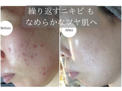 ネーム(Nemu)の写真